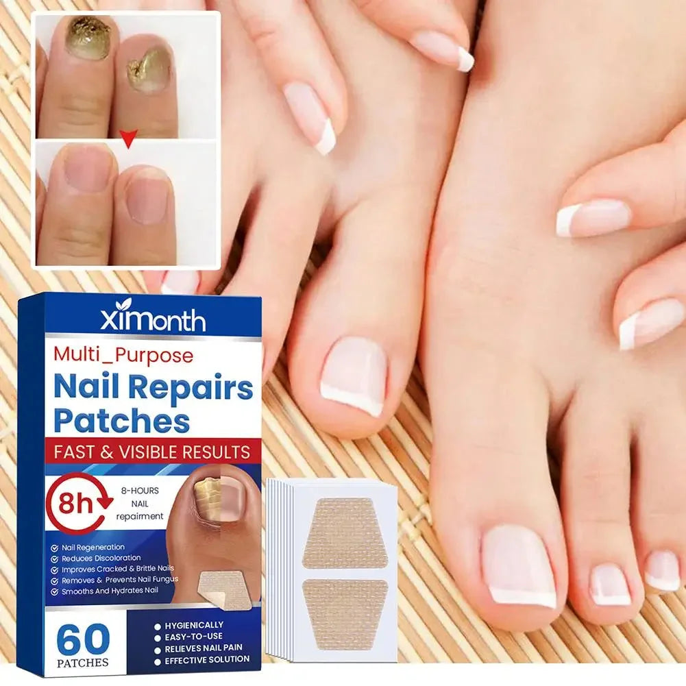 Discreet Fungal Nail Repair Patches — photo 2