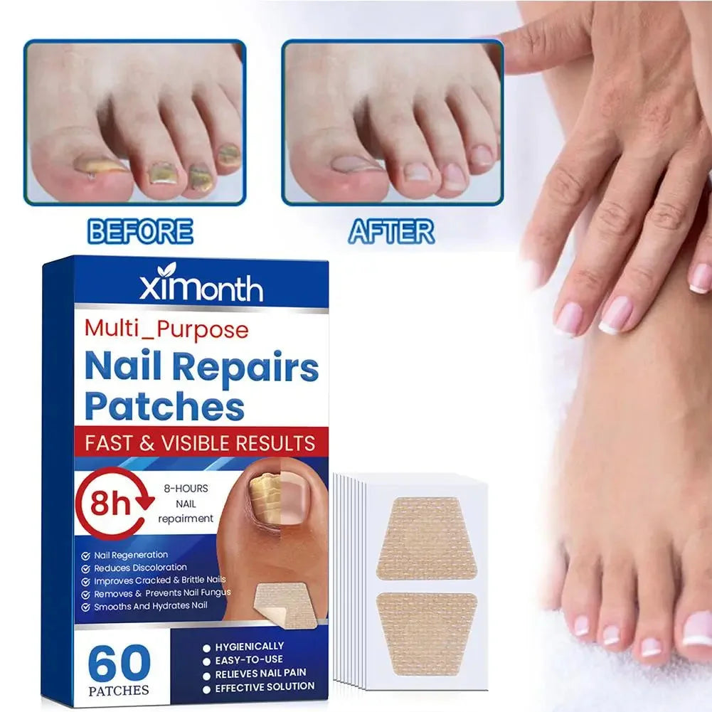 Discreet Fungal Nail Repair Patches — photo 3